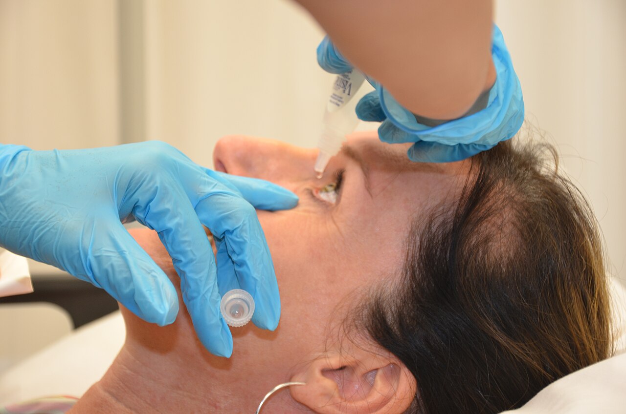 A medical professional applying eye drops to a patient's eye.