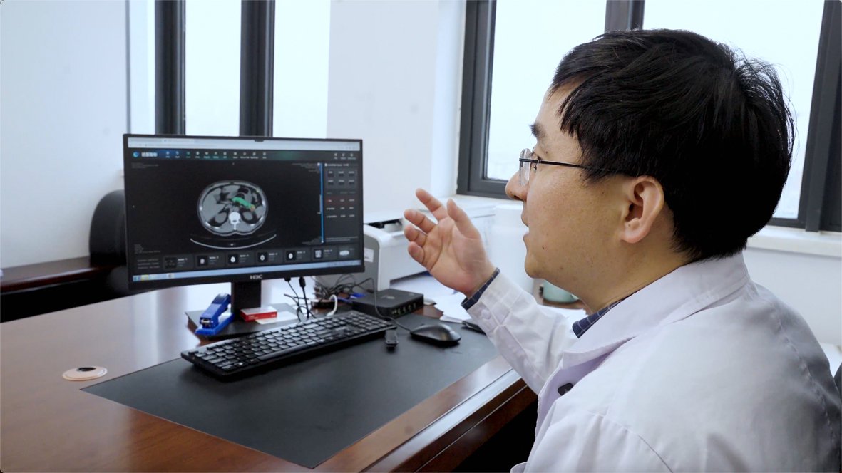 A physician at Ningbo University Affiliated People's Hospital reviews a pancreatic CT scan on a desktop monitor.
