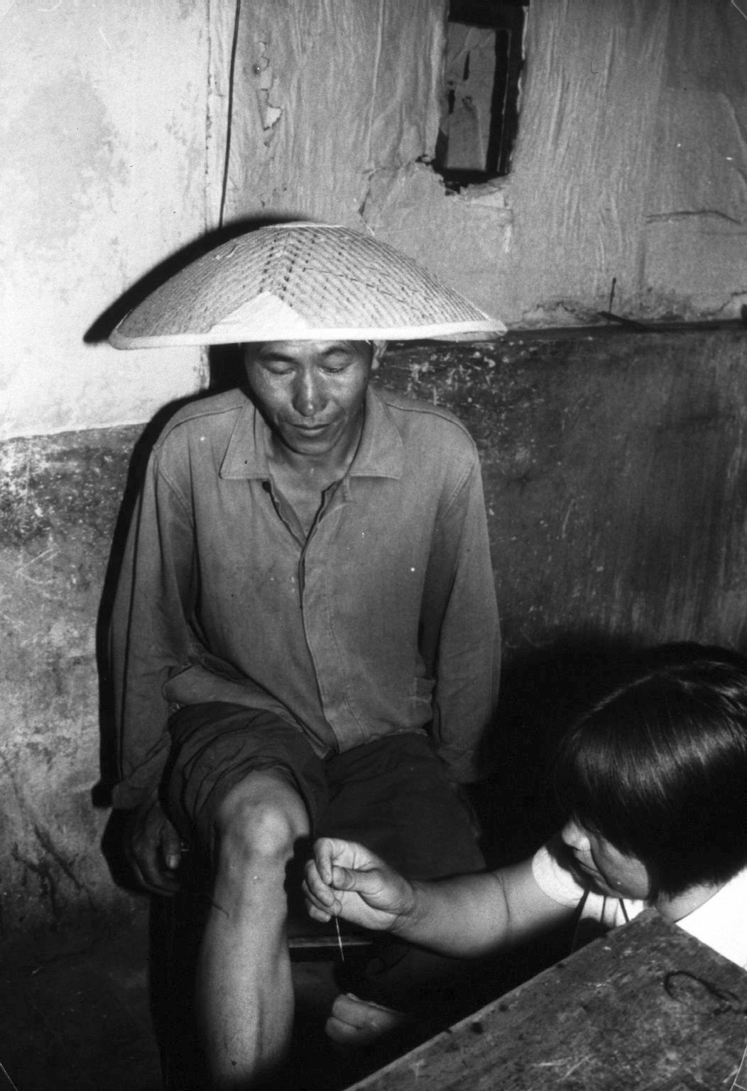 Black-and-white archival photograph of a Chinese barefoot doctor using acupuncture needles to treat a seated production brigade worker.