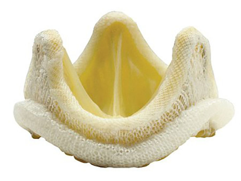 A preserved porcine heart valve with tissue leaflets mounted in a pale, fabric-covered supporting frame.