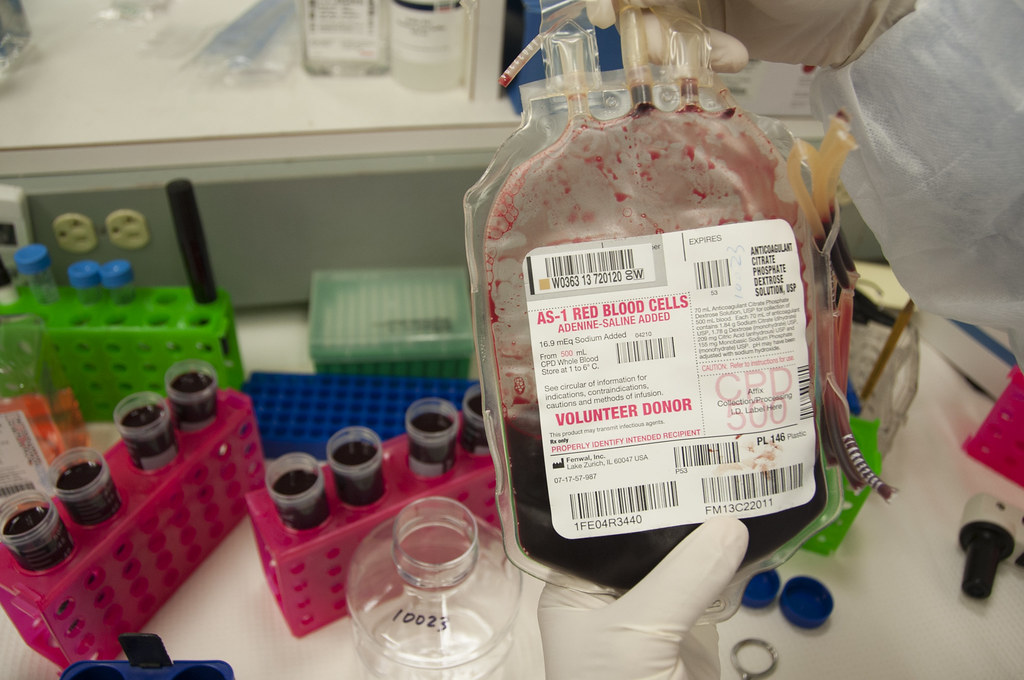 Gloved hands hold a labeled red-cell bag above racks of sample tubes in an FDA laboratory.